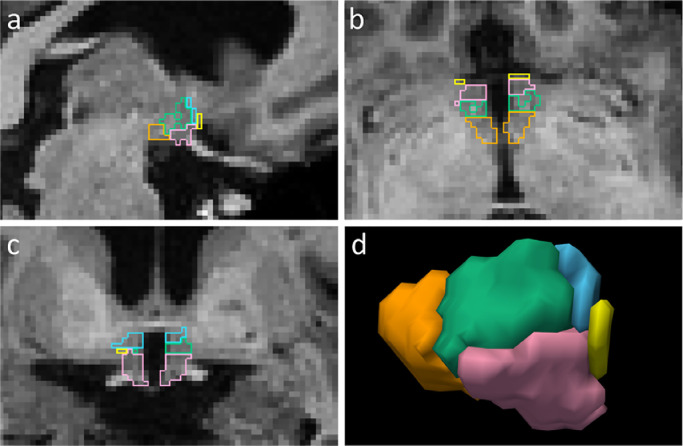 Fig. 3