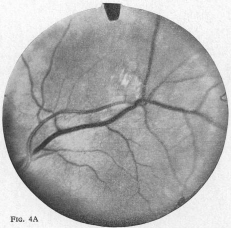 Fig. 4A