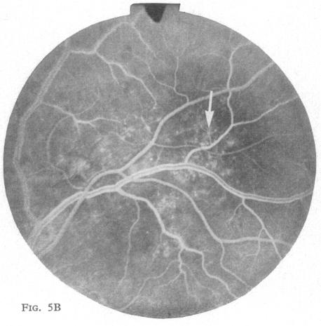 Fig. 5B