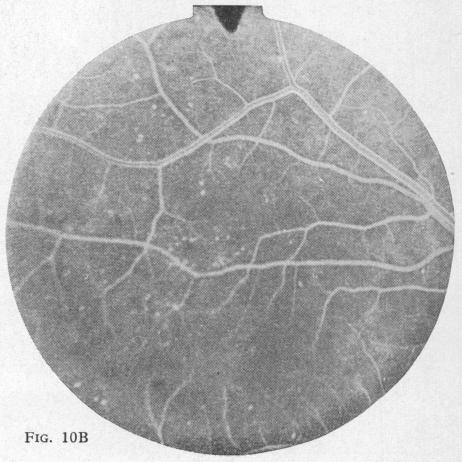 Fig. 10B