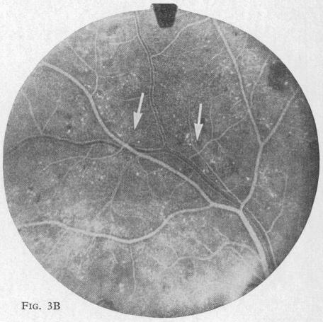 Fig. 3B