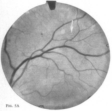 Fig. 5A