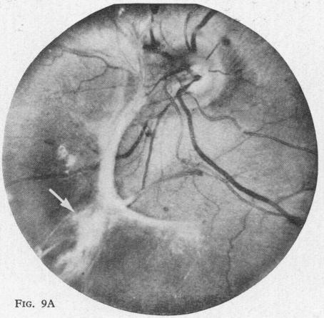 Fig. 9A