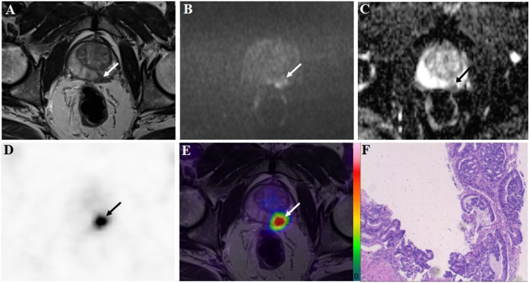 Figure 1