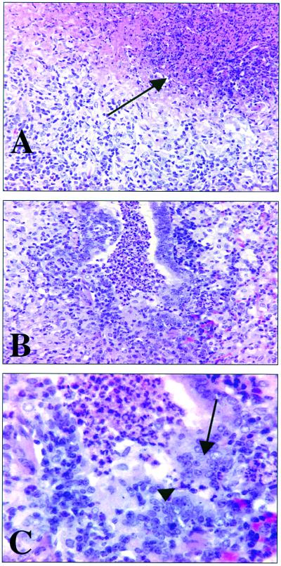 FIG. 3