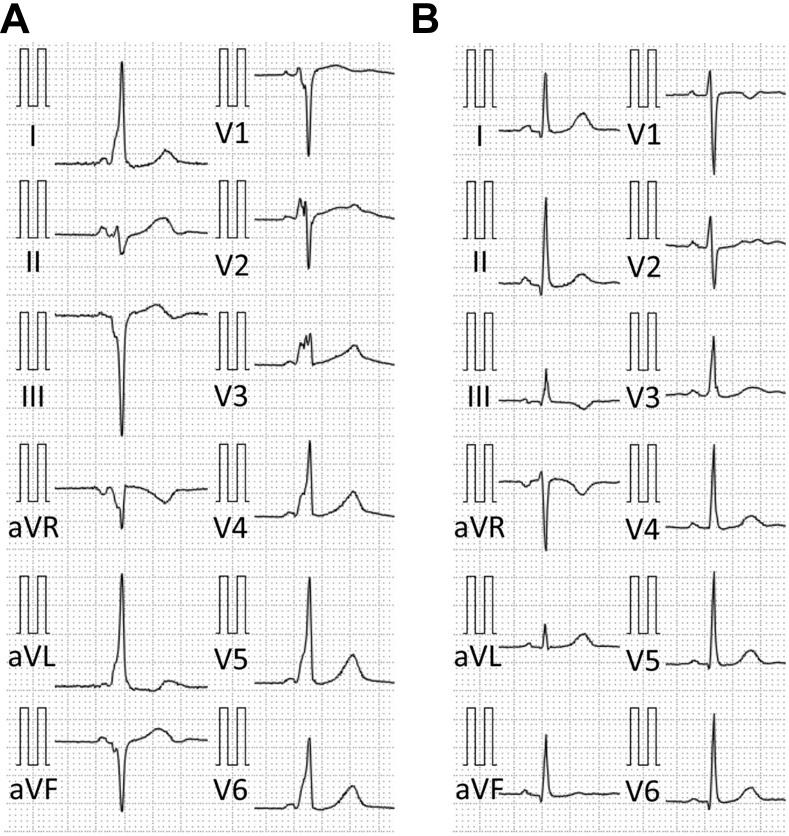 Figure 1