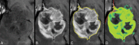 Fig 4.