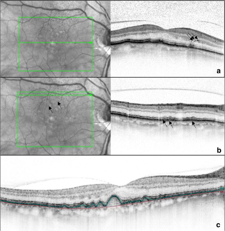 Fig. 1