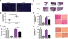 Figure 2. Cardiac ATF3-transgenic promotes cancer cell proliferation. A Representative image of PyMT tumor sections of control and ATF3-transgenic stained with anti-Ki67 (proliferating cells; red) and DAPI (nuclei; blue). Scale bar, 50 µm. B Quantification of the number of proliferating cells in tumor section field. Each dot represents the mean of five fields in tumor section derived from a single mouse (n = 4 mice each) C PyMT cells were cultured for 48 hours in the absence or supplemented with 10%: FBS, mouse blood serum drawn from either control or ATF3-transgenic. Proliferation was measured by Luminescent Cell Viability Assay kit using serum derived from at least three mice per group (n = 4 wells per treatment). D, Tumor sections derived from either ATF3-transgenic or control mice (n = 3 mice per group shown). Scale bar, 200 μm. Migration (E) and invasion (F) of PyMT cells assessed by Boyden chamber assays in the presence of fibronectin or Matrigel, respectively. Representative images are shown. Scale bar, 200 µm. Cell coverage were quantified from the images (n = 5–8 fields/group). Data are presented as mean ± SD. Student t test (B) or one-way repeated measures ANOVA followed by Tukey posttests (C, E, F). *, P < 0.05; **, P < 0.01; ***, P < 0.001.