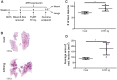 Figure 3. Cardiac dysfunction enhances cancer cell colonization to the lungs in ATF3-transgenic mice model. A, Schematic experimental timeline for ATF3-transgenic and control mice followed by PyMT cell pulmonary experimental metastasis assay by tail vein injection (TV Inj.) of 2×106 cells per mouse; Control (Cont.; n = 3) or ATF3-transgenic (ATF3 tg.; n = 4) female mice. B, Representative image of lung sections stained with hematoxylin and eosin (H&E). Scale bar, 1,000 µm. C, Number of metastatic lesions in the lungs. D, Average area of the metastatic lesions. Data are presented as mean ±SD. Student t test. *, P < 0.05.