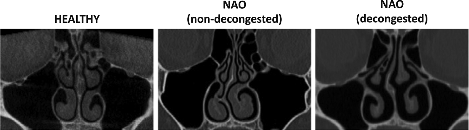Figure 1 -