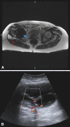 Fig. 1A–B