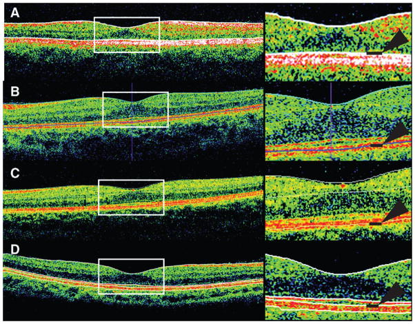 Figure 11