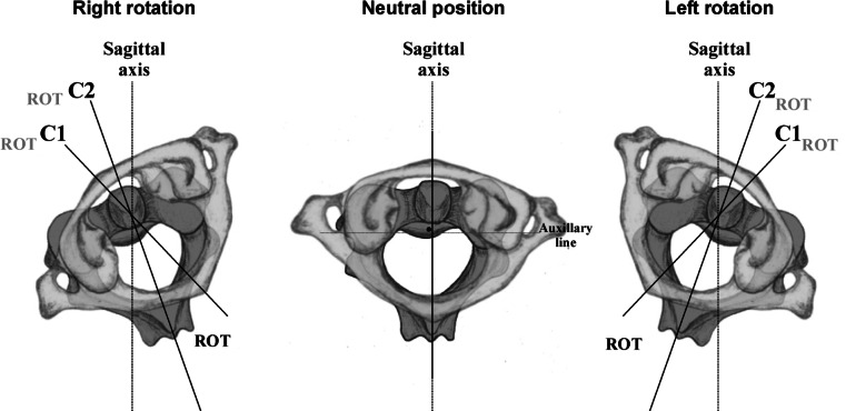 Fig. 1