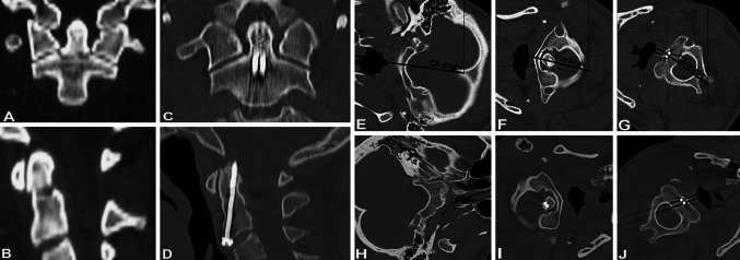 Fig. 2