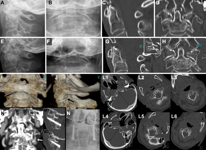 Fig. 3