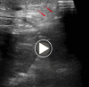 Video 1