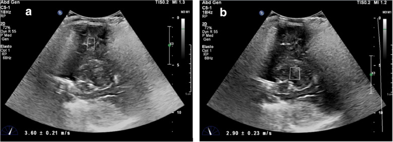 Fig. 5