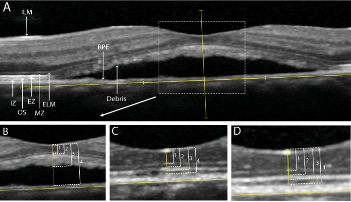 Fig 2