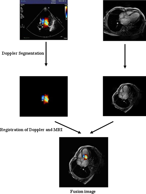 Fig. 1