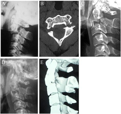 Fig. 4