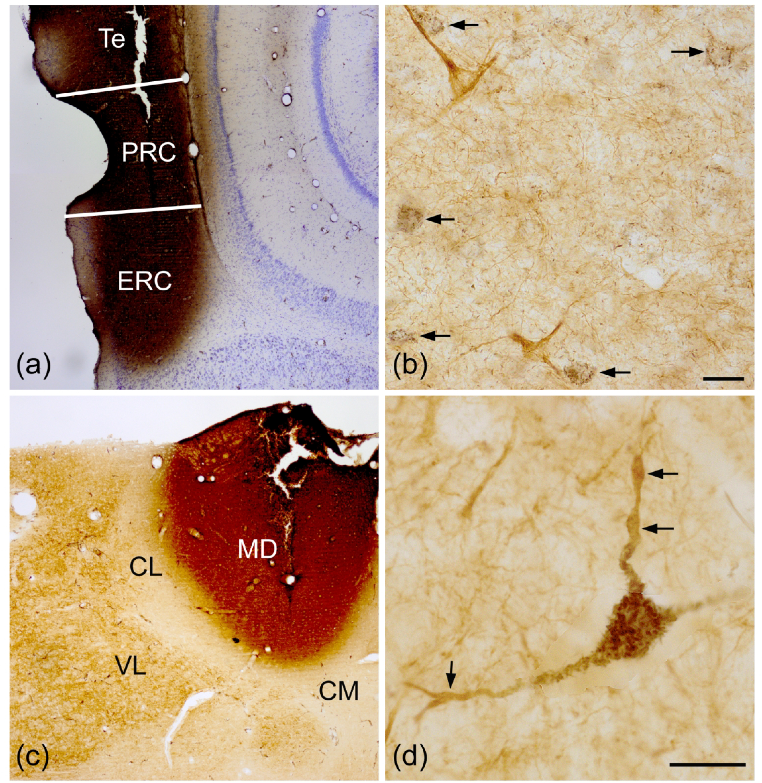 Fig. 11.