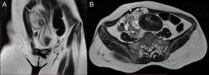 Figure 2