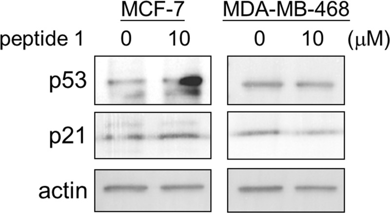 Fig 14