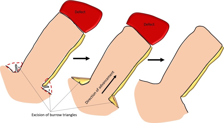 Fig. 2