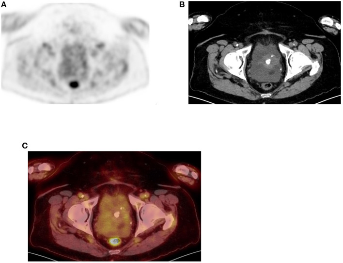 Figure 14