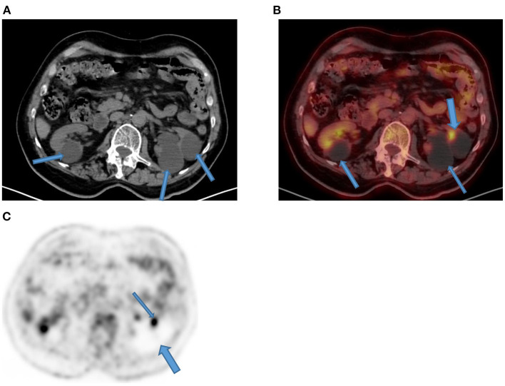 Figure 16