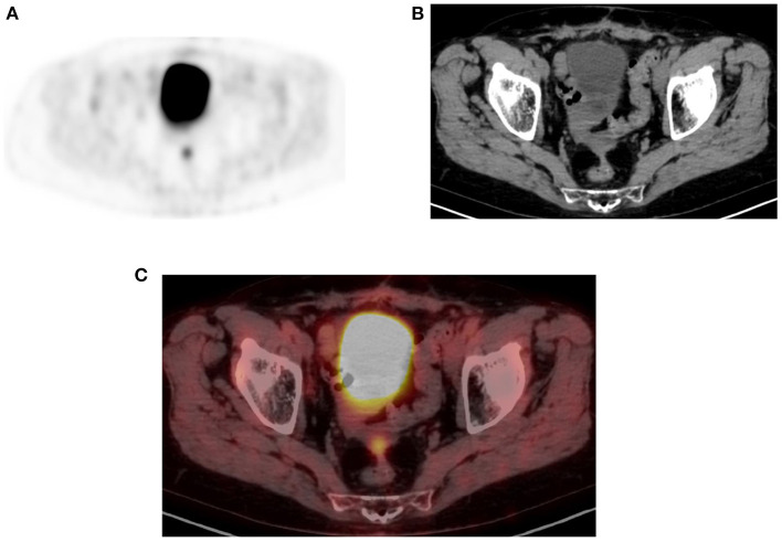 Figure 15