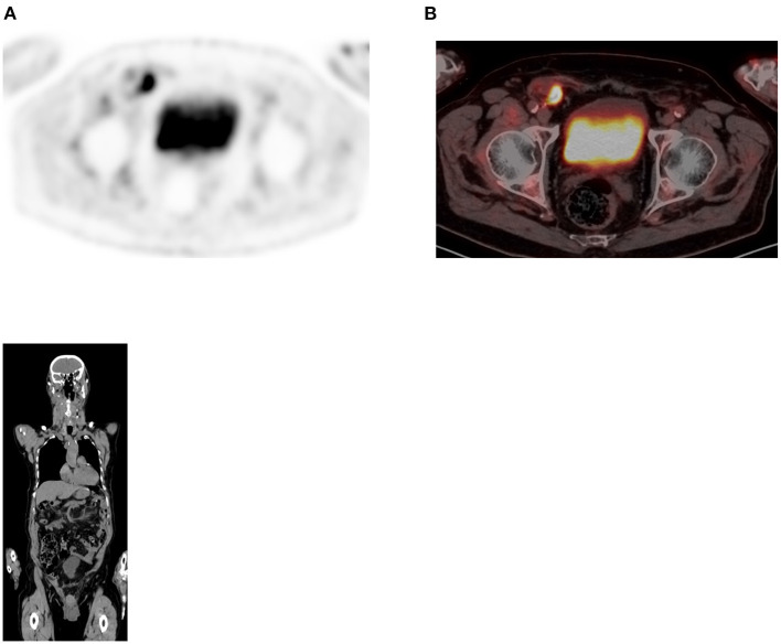 Figure 17