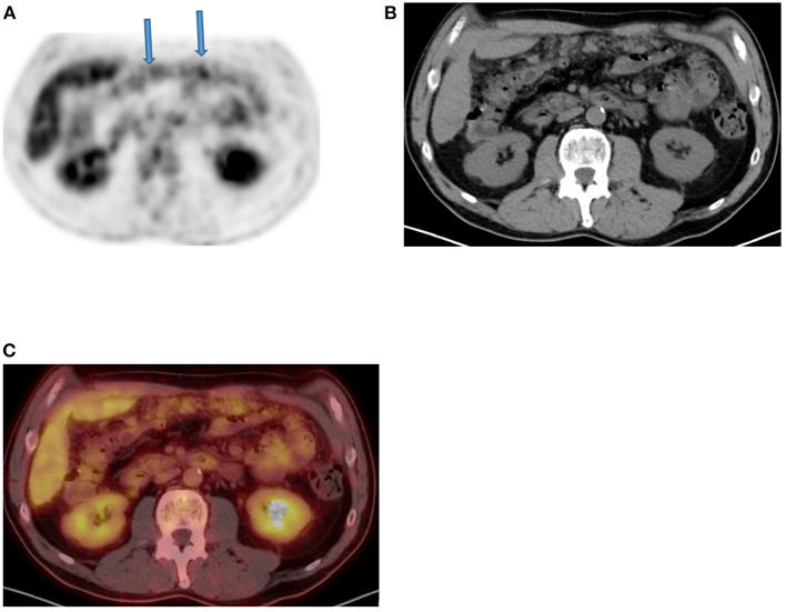 Figure 12