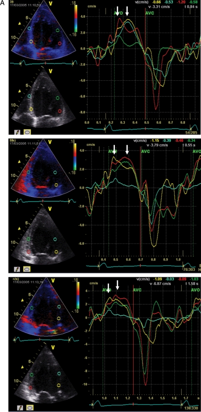 Figure 6