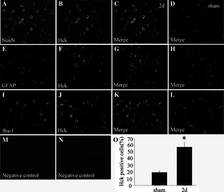 Hck Promotes Neuronal Apoptosis Following Intracerebral Hemorrhage - PMC