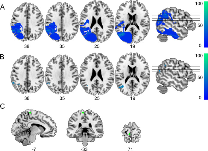 Figure 3—figure supplement 1.