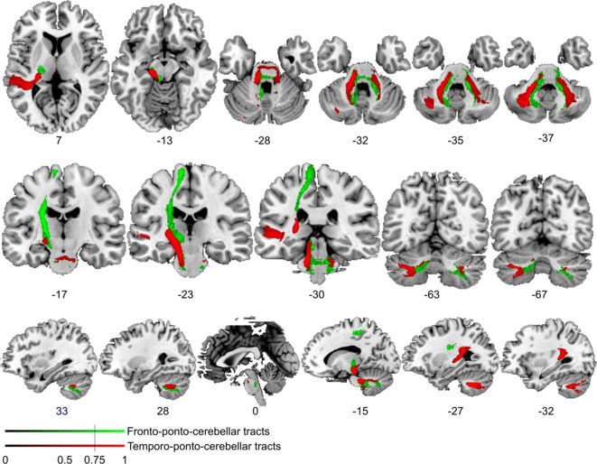 Figure 4—figure supplement 2.