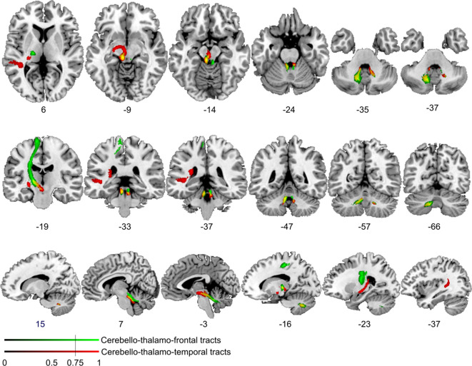 Figure 4—figure supplement 3.