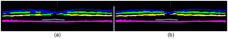 Fig. 11