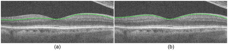 Fig. 14