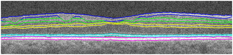 Fig. 12