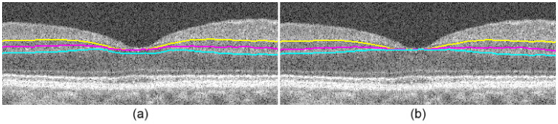 Fig. 15