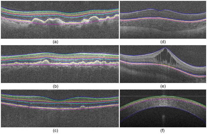 Fig. 17