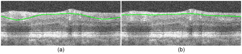 Fig. 13