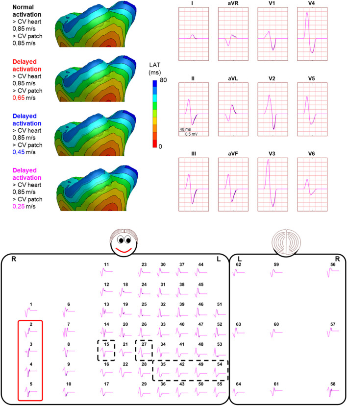 FIGURE 4