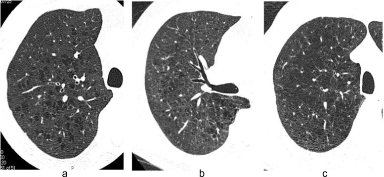 Fig. (1)