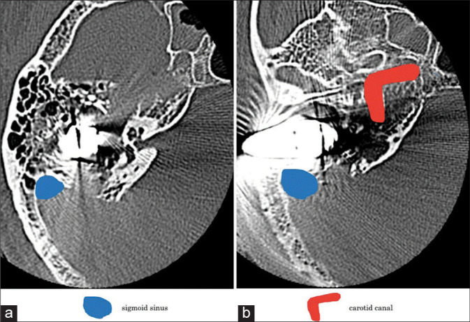 Figure 2: