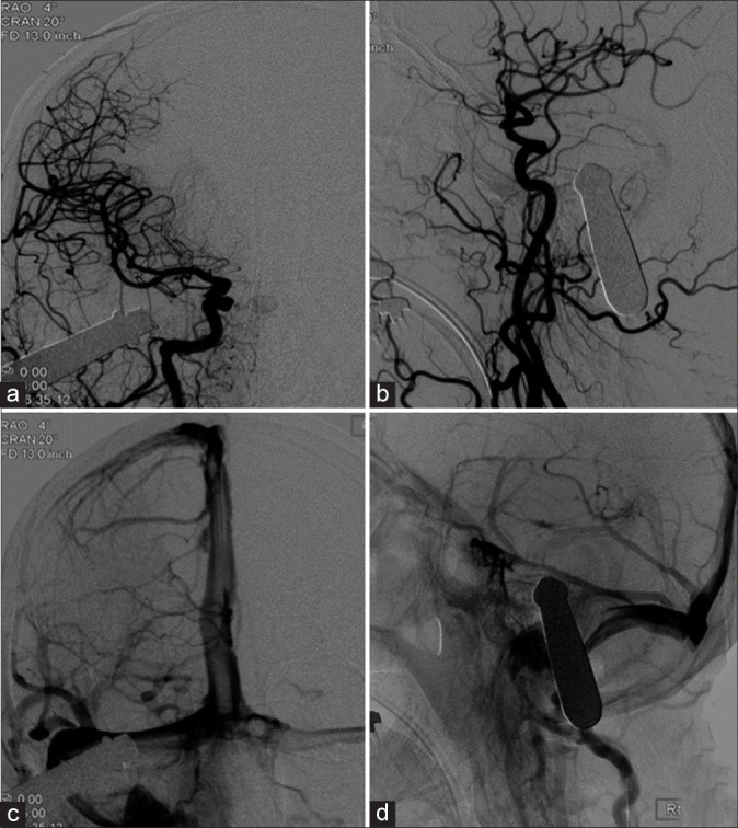 Figure 3: