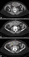 Fig. 1